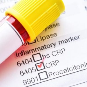 Il test della proteina C-reattiva ha molteplici applicazioni