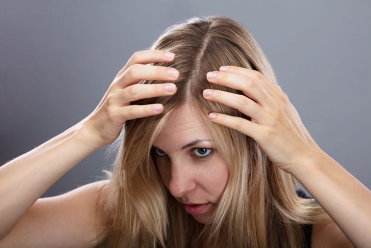 10 cause più comuni di infezioni del cuoio capelluto 9