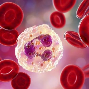 Neutrofili insufficienti e sindrome di Kostmann genetica Neutrofili insufficienti e sindrome di Kostmann genetica