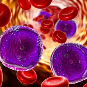Sintomi, prevenzione e trattamento della sindrome da lisi tumorale Sintomi, prevenzione e trattamento della sindrome da lisi tumorale