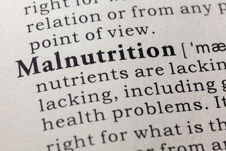 Malnutrizione: Cause, sintomi e trattamenti 1