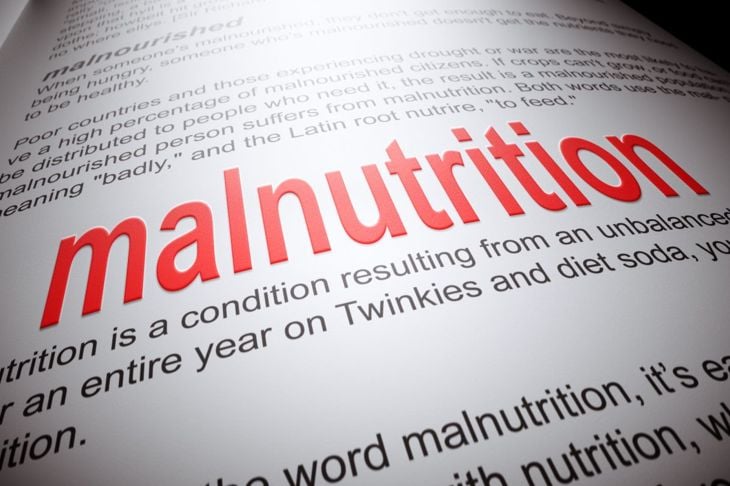 Malnutrizione: Cause, sintomi e trattamenti 15