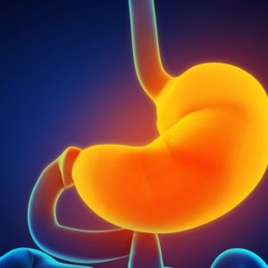 Che cos’è la sindrome da dumping? Che cos’è la sindrome da dumping?