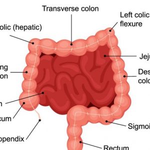 Tipi di procedure di ileostomia e possibili rischi Tipi di procedure di ileostomia e possibili rischi