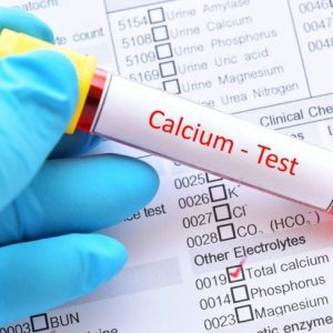 Come i medici trattano questi 5 tipi di calcinosi cutis Come i medici trattano questi 5 tipi di calcinosi cutis