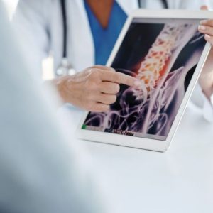 Che cos’è la sindrome della cauda equina? Che cos’è la sindrome della cauda equina?