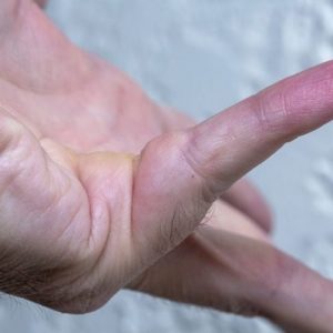 La contrattura e le sue numerose cause La contrattura e le sue numerose cause