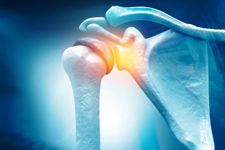 Cause comuni di dolore alla spalla 5