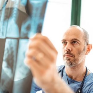 Fibrosi polmonare e cicatrici polmonari Fibrosi polmonare e cicatrici polmonari