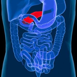 Tumori del pancreas: Sindrome di Zollinger-Ellison Tumori del pancreas: Sindrome di Zollinger-Ellison