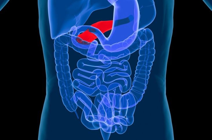 Tumori del pancreas: Sindrome di Zollinger-Ellison 1