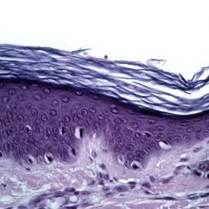 Come il derma influisce sulla salute generale Come il derma influisce sulla salute generale