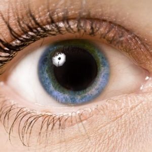 Cause e trattamenti delle pupille dilatate