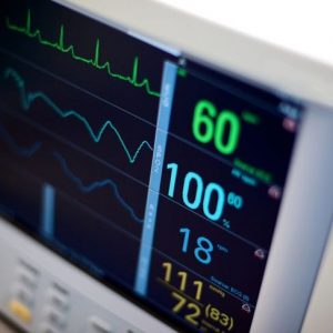 I ritmi cardiaci irregolari della bigeminalità I ritmi cardiaci irregolari della bigeminalità