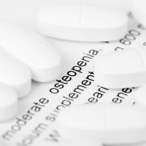 Domande frequenti sull’osteopenia Domande frequenti sull’osteopenia
