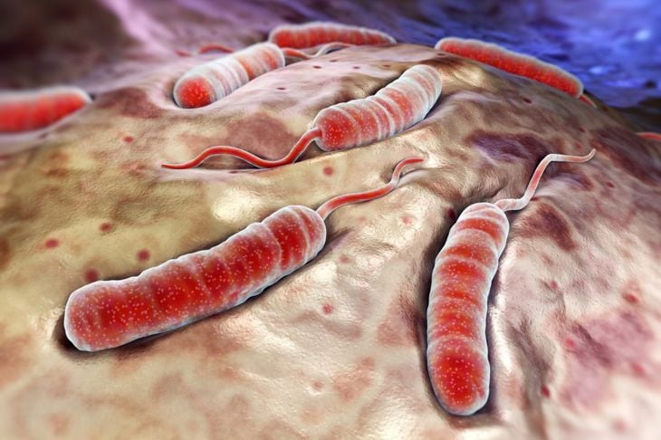 Cause e trattamenti del colera 5