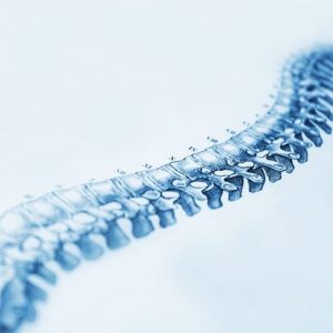 Che cos’è la malattia di Scheuermann? Che cos’è la malattia di Scheuermann?