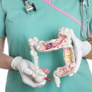 Cause e trattamento dell’appendicite