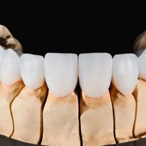 L’anatomia dei denti