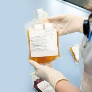 Le parti del sangue: Cos’è il plasma?