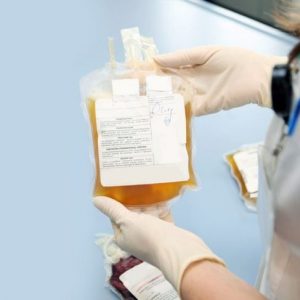 Le parti del sangue: Cos’è il plasma? Le parti del sangue: Cos’è il plasma?