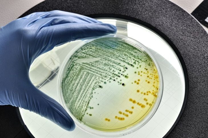 Cause e trattamenti dell'E. coli 3