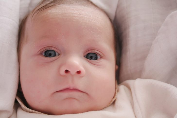 Un'eruzione cutanea sul viso del bambino: Aspettare o preoccuparsi? 1