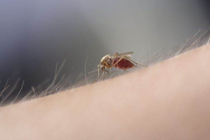 Punture di zanzara gravi: sindrome di Skeeter 3