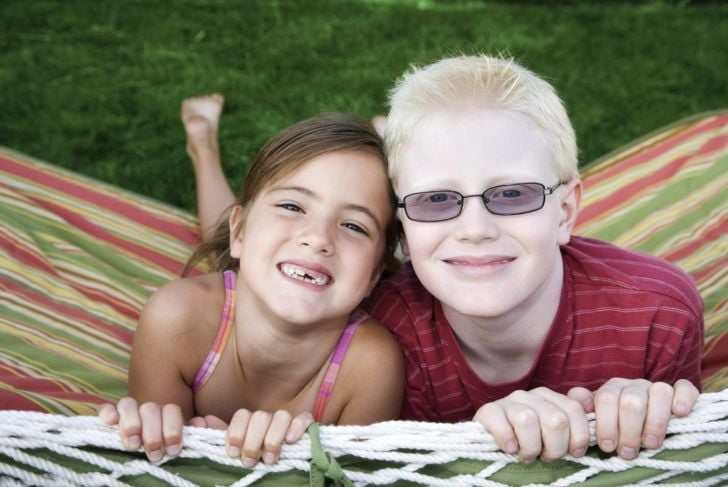 10 cose che non sapevate sull'albinismo 11