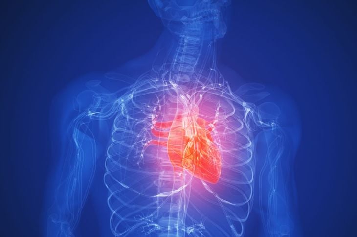 Che cos'è la cachessia cardiaca? 1