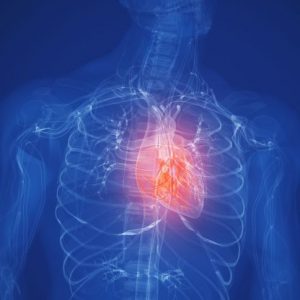 Riconoscere e affrontare la tamponatura pericardica Riconoscere e affrontare la tamponatura pericardica
