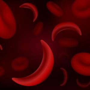 10 sintomi dell’anemia falciforme 10 sintomi dell’anemia falciforme