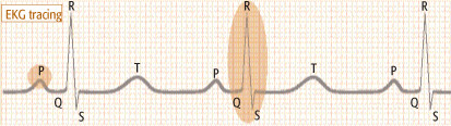 Elettrocardiogramma (ECG)