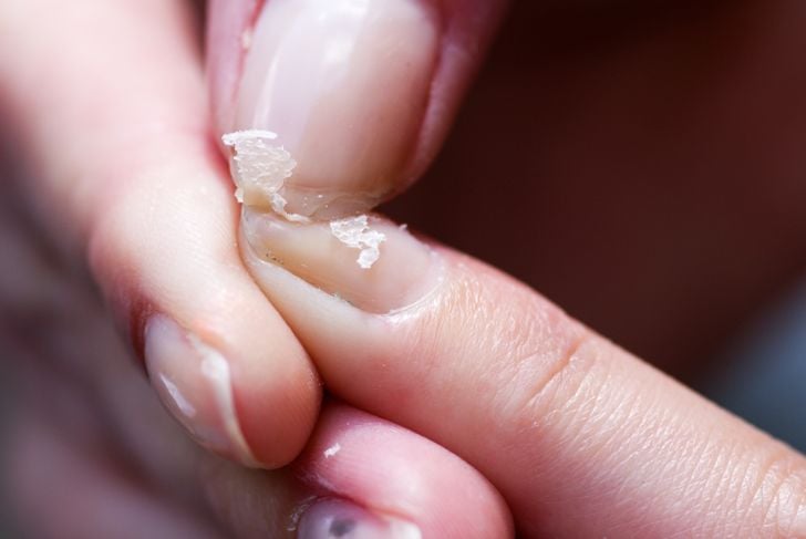 10 cose inquietanti che le unghie rivelano sulla vostra salute 9