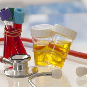 10 domande frequenti sul sangue nelle urine 10 domande frequenti sul sangue nelle urine