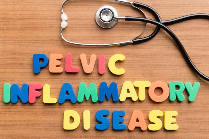 Sintomi e trattamenti della malattia infiammatoria pelvica 7