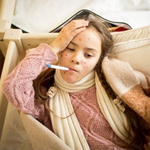 Che cos’è la varicella? Sintomi e trattamento Che cos’è la varicella? Sintomi e trattamento
