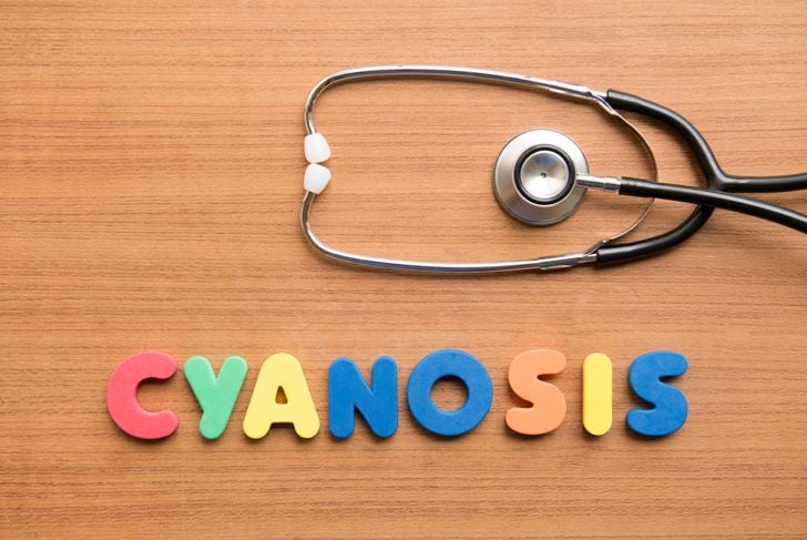 10 Cause, sintomi e trattamenti: Pneumotorace 7