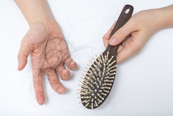 Che cos'è l'alopecia areata? 5