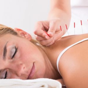8 benefici dell’agopuntura per la salute 8 benefici dell’agopuntura per la salute