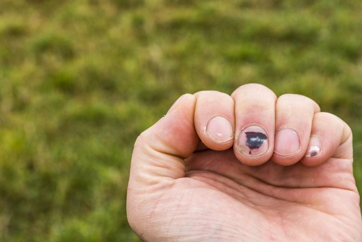 10 cose inquietanti che le unghie rivelano sulla vostra salute 7