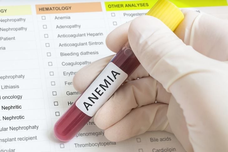 10 trattamenti per l'anemia 13