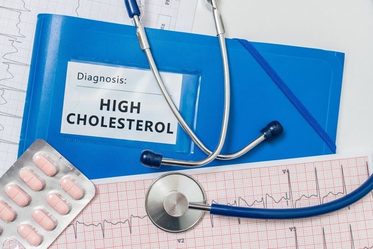 10 miti sul colesterolo sfatati 9