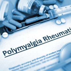 10 sintomi della polimialgia reumatica