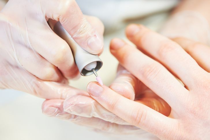 10 cose inquietanti che le unghie rivelano sulla vostra salute 19