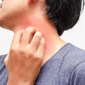 10 sintomi di infezione da stafilococco 10 sintomi di infezione da stafilococco