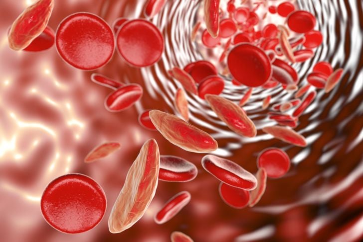 10 trattamenti per l'anemia 11