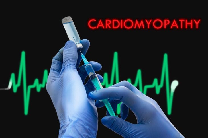 10 Sintomi e trattamenti della cardiomiopatia 15