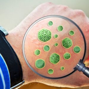 Domande frequenti sulla dermatite da contatto Domande frequenti sulla dermatite da contatto