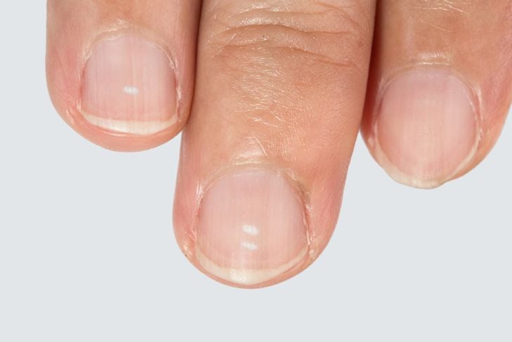 10 cose inquietanti che le unghie rivelano sulla vostra salute 5